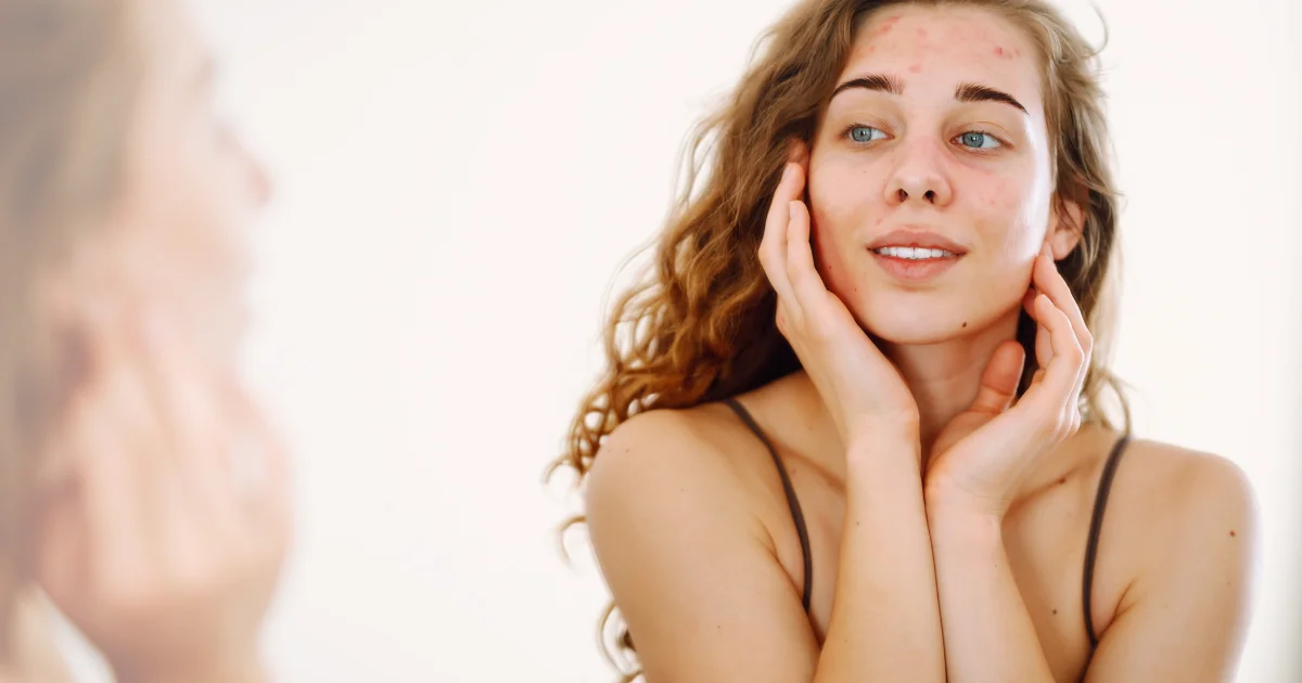 ganzheitliche Hautpflege Haut verstehen naelco skinfood